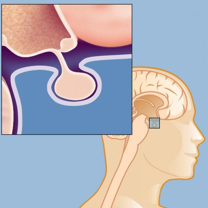 disease of the pituitary gland symptoms