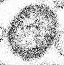 das Masernvirus Mikrobiologie