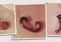 Nedir bloodworm ve ne için kullanılır?