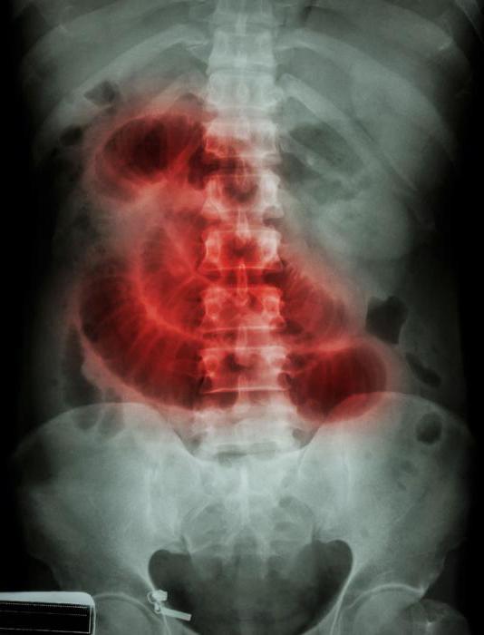 la radiografía del abdomen