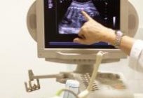 On what terms do ultrasound during pregnancy. How many times do ultrasound
