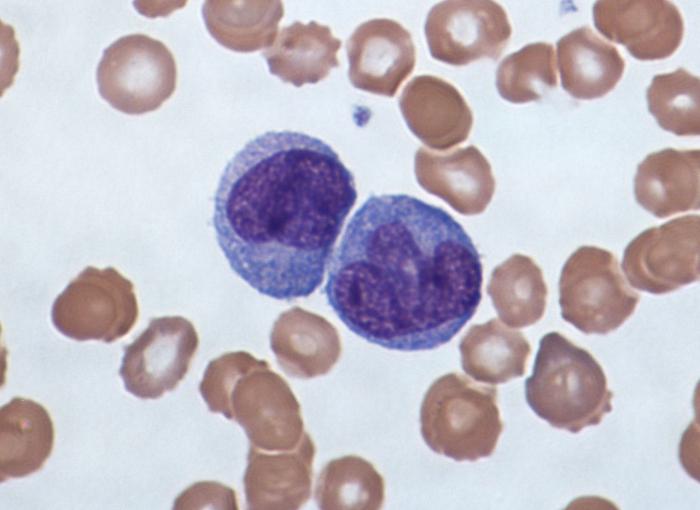 升高的单核细胞在血液中的儿童