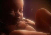 A placenta da parede do útero: um motivo para preocupações ou opção normais?