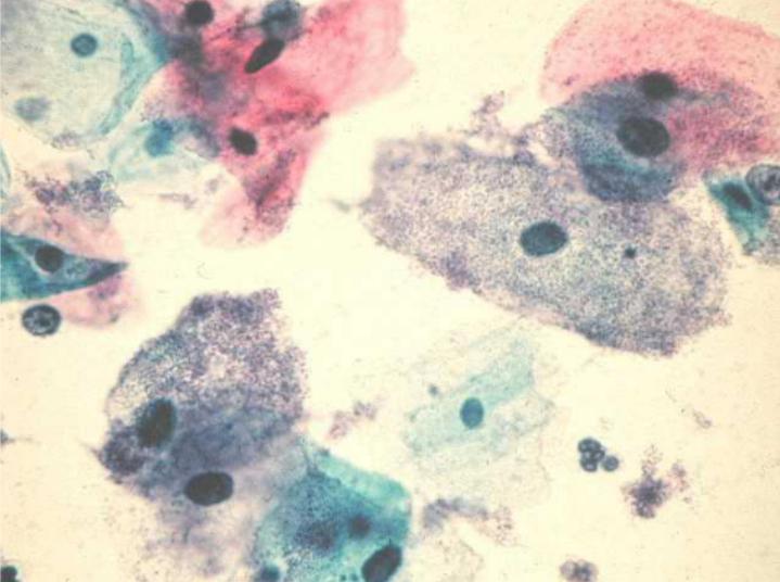 la Bacteria bajo el microscopio