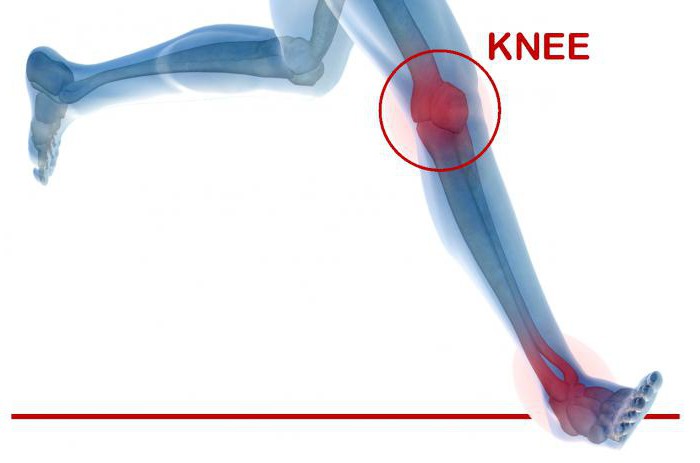 заміна колінного суглоба після операції