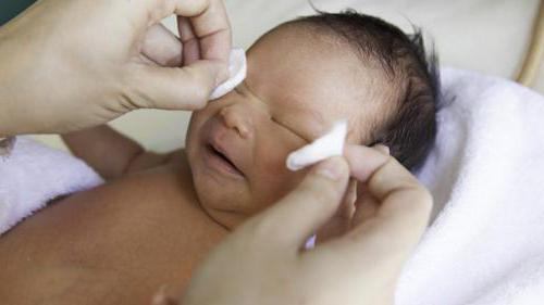 wie machen Massage lacrimal Kanäle bei Neugeborenen