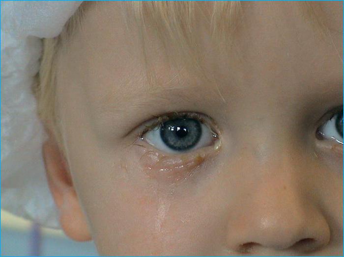 wie machen Massage lacrimal Kanäle Neugeborenen Fotos