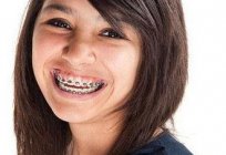 Braces and pregnancy: is it possible to wear braces during pregnancy?