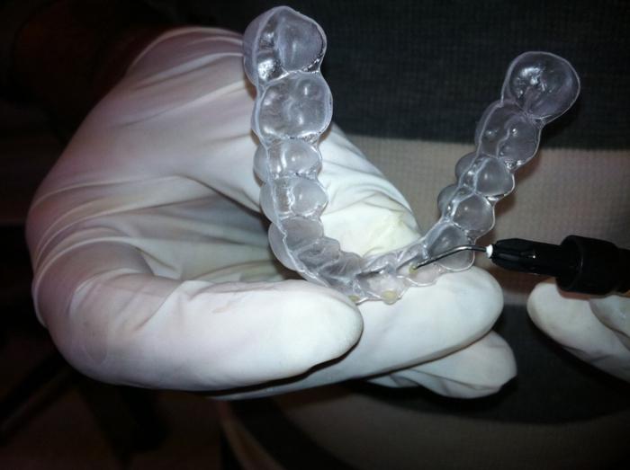 ortodontia correcção aparelho nos dentes