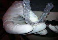 के संरेखण दांत में orthodontics