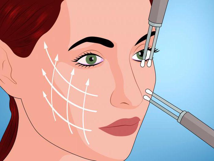 Wie zu entfernen Lefzen auf Ihr Gesicht Bewertungen