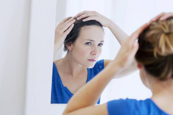 Alopezie bei Frauen Bewertungen