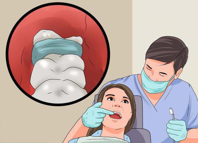 альвеолах пасля выдалення зуба лячэнне дома
