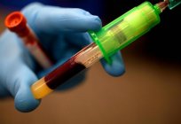 Leucopenia - isso é sério: como reconhecer e curar perigosa doença do sangue?