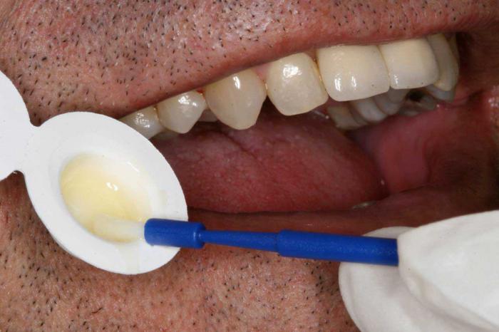 tief Fluoridierung der Zähne