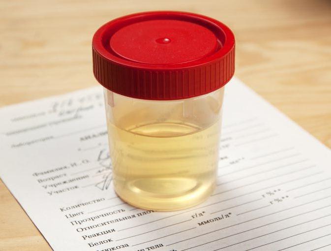 análise de urina para plantar