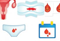 侵犯menstrualnogo周期：原因和治疗