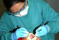 है क्या periodontal रोग है? इसके कारण