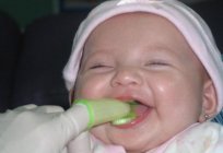 Gelber Belag auf der Zunge bei Kindern: Behandlung, Ursachen und Begleiterscheinungen
