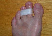 Swollen toe: causes, treatment, what doctor to address