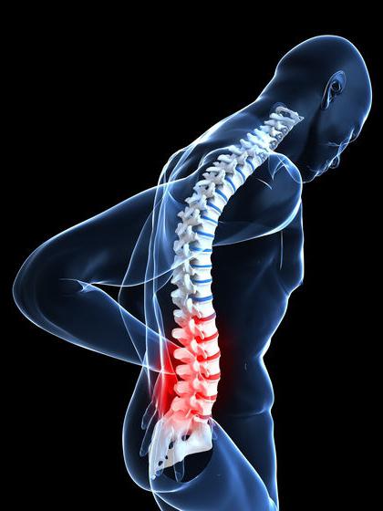even the treatment of hernias of a backbone