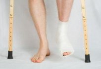 足骨骨折の種類は、症状の治療