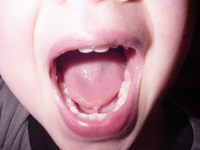 анатомія паражніны рота чалавека