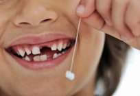 Rozeznanie, ile zębów mlecznych u dziecka powinno być