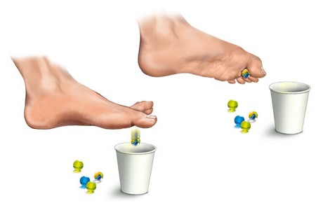 esporas nos pés tratamento