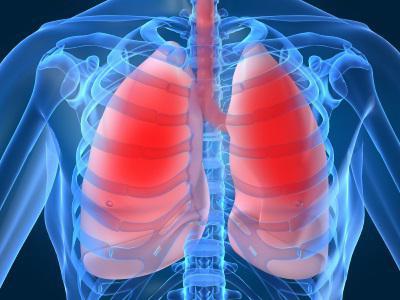 idiopathische Lungenfibrose