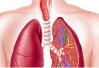 原发性肺纤维化治疗和建议