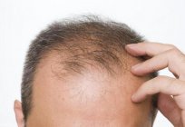 The drug from hair loss 