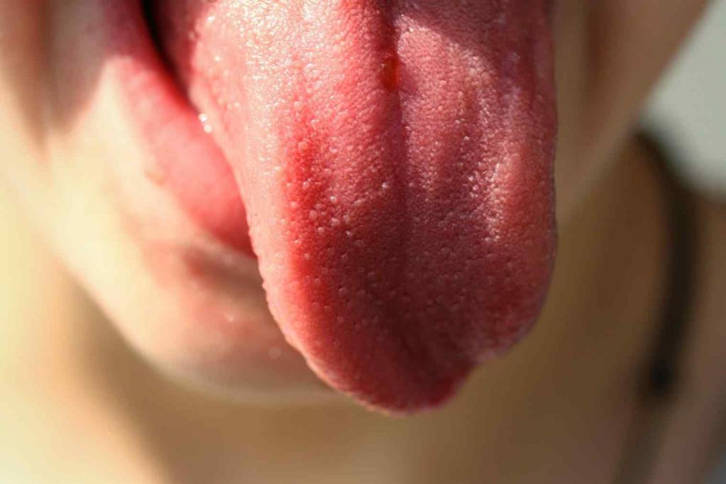 la Inflamación en la cavidad de la boca