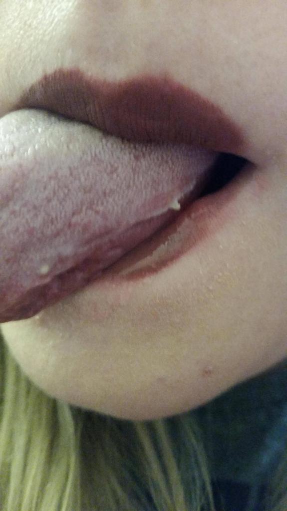 la Enfermedad con воспаленным la lengua