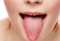 Uma espinha na língua: causas e tratamento