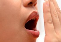 Como retirar o cheiro de alho da boca: as maneiras mais eficientes de que não irá decepcionar