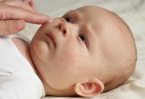 毒性紅斑の新生:原因、治療