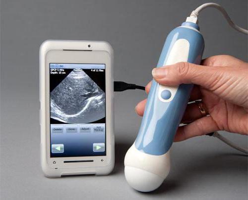 como fazem доплер de ultra-som durante a gravidez
