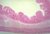 Stomach: histology, development and structure