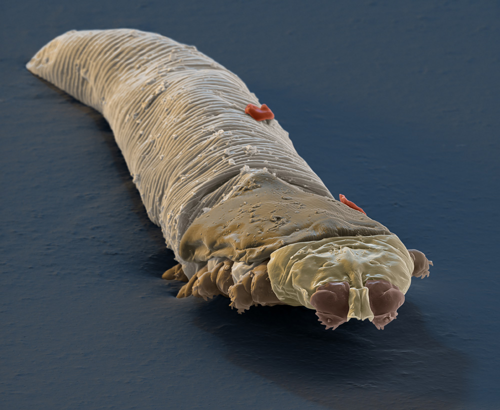 蠕形螨在显微镜下