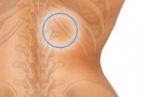 ¿Qué es el chichón en la espalda cerca de la columna vertebral y cómo se cura?