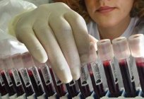 كيفية حل المشاكل على فصيلة الدم RH