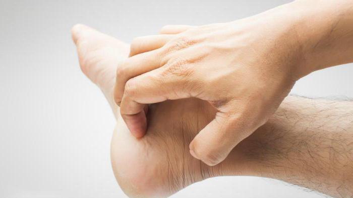 ein Ausschlag auf den Handflächen und den Fußsohlen Ursachen und Behandlung